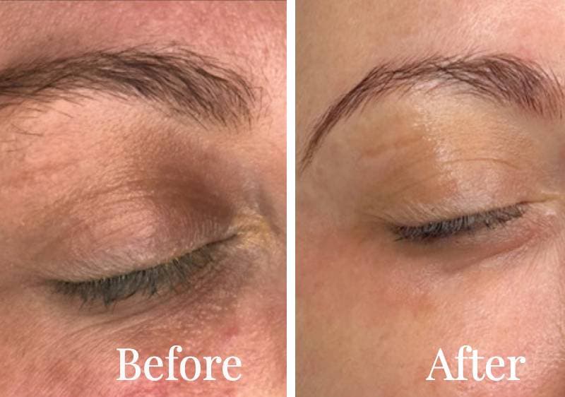 Close-up of a person's eyes showing eyebrow before and after beauty eye treatments; left side is untidy and the right side is neatly shaped.