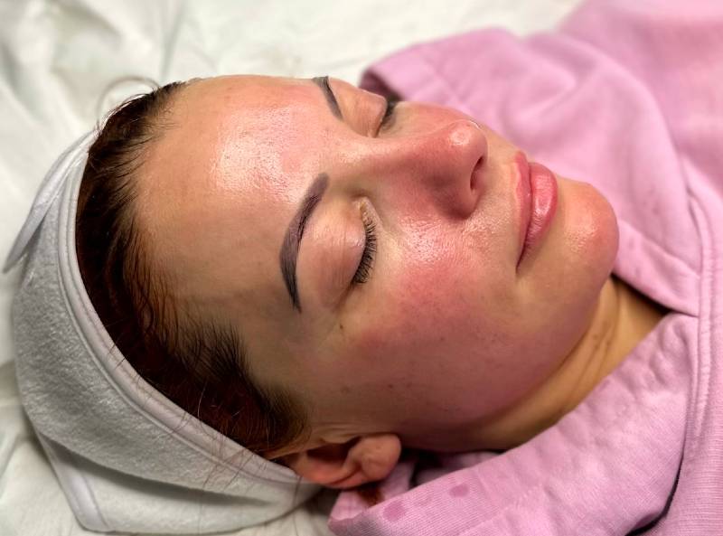Close-up of a woman with closed eyes, wearing a headband and a pink robe, lying down with a relaxed expression after a dermaplaning facial.