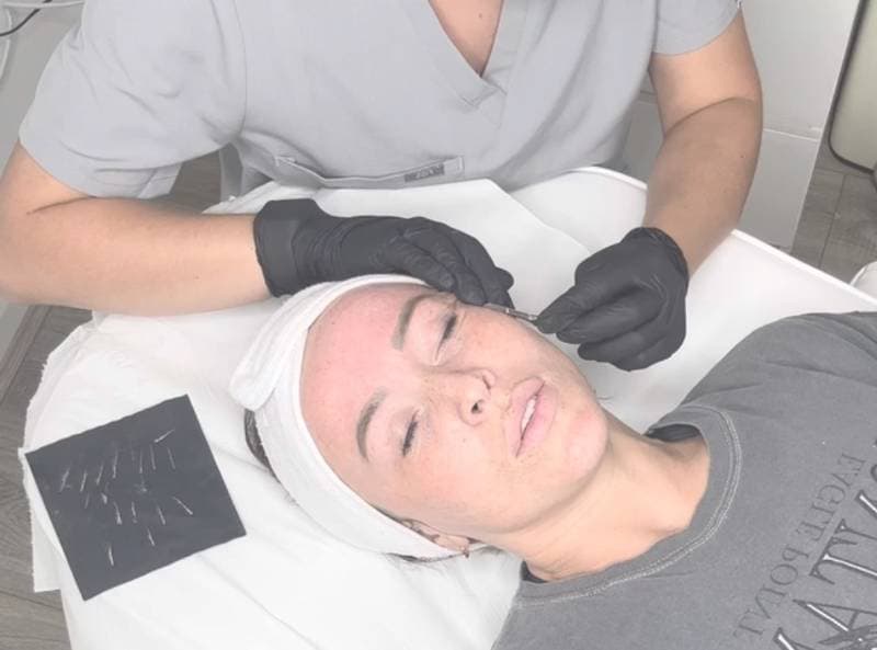 Aesthetician in gloves performing a dermaplaning facial on a woman's face.