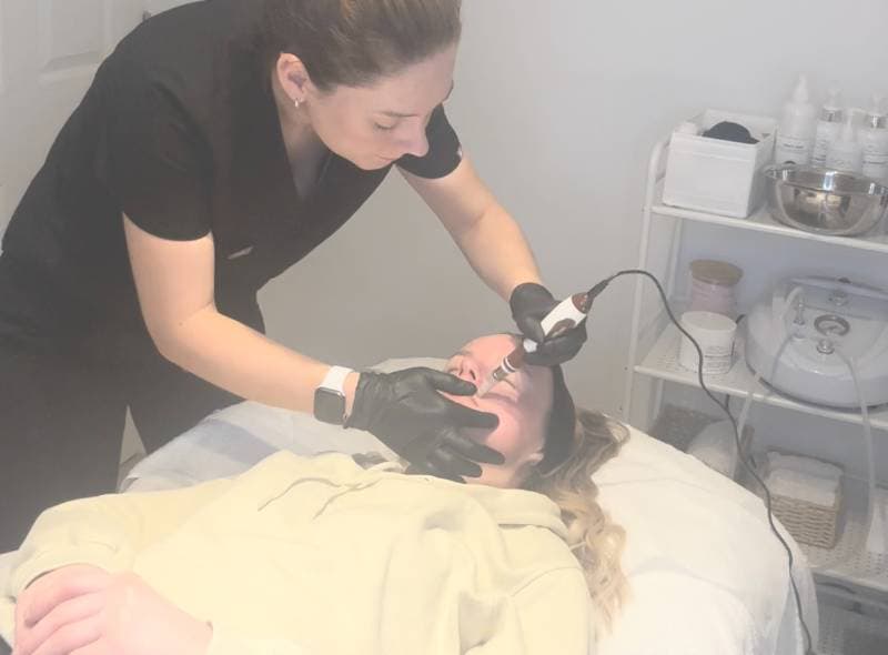 Aesthetician performing a micro needling treatment on a female client in a clinic, using a handheld device.