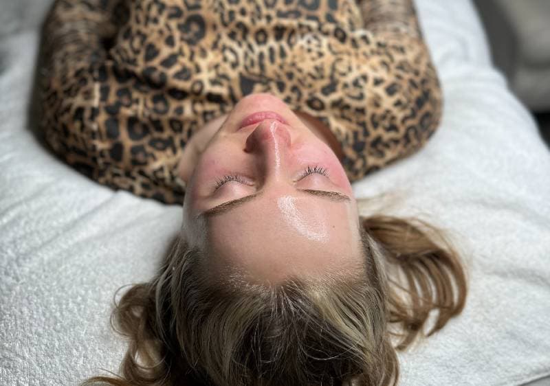 A woman lying on a bed with her eyes closed after a Chemical Peel treatment.